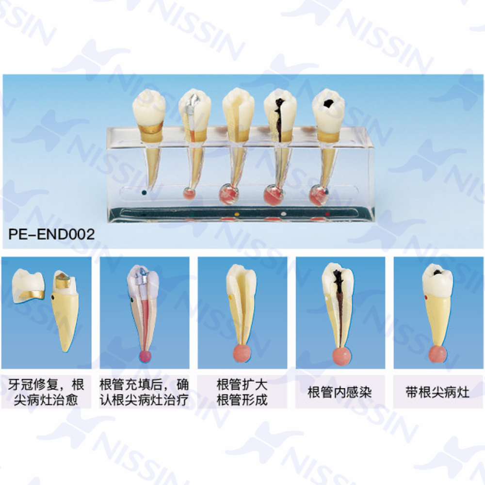 牙體牙髓病臨床模型